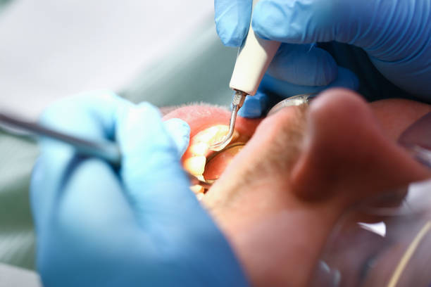 Best Emergency Treatment for Toothache in Herrin, IL